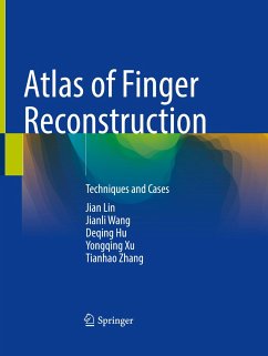 Atlas of Finger Reconstruction - Lin, Jian;Wang, Jianli;Hu, Deqing