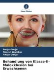 Behandlung von Klasse-II-Malokklusion bei Erwachsenen