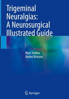 Trigeminal Neuralgias: A Neurosurgical Illustrated Guide - Sindou, Marc;Brinzeu, Andrei