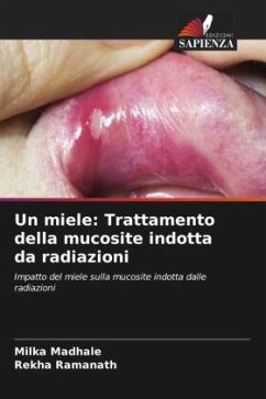 Un miele: Trattamento della mucosite indotta da radiazioni - Madhale, Milka;Ramanath, Rekha