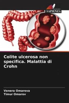 Colite ulcerosa non specifica. Malattia di Crohn - Omarova, Venera;Omarov, Timur