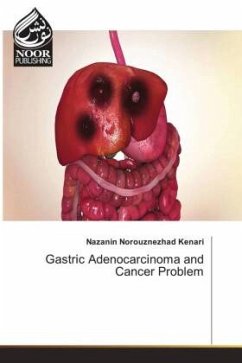 Gastric Adenocarcinoma and Cancer Problem - Norouznezhad Kenari, Nazanin