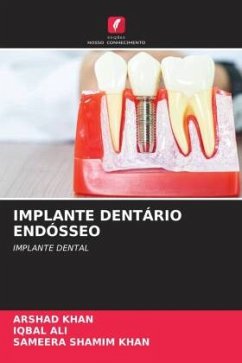 IMPLANTE DENTÁRIO ENDÓSSEO - Khan, Arshad;Ali, Iqbal;Khan, Sameera Shamim