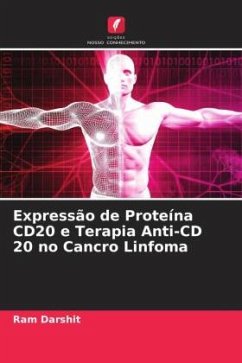 Expressão de Proteína CD20 e Terapia Anti-CD 20 no Cancro Linfoma - Darshit, Ram
