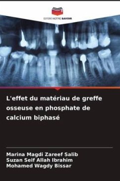 L'effet du matériau de greffe osseuse en phosphate de calcium biphasé - Magdi Zareef Salib, Marina;Seif Allah Ibrahim, Suzan;Wagdy Bissar, Mohamed