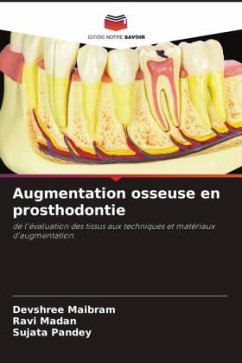 Augmentation osseuse en prosthodontie - Maibram, Devshree;Madan, Ravi;Pandey, Sujata