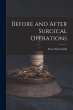 Before and After Surgical Operations - Bild 1