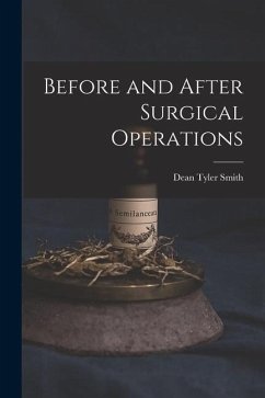Before and After Surgical Operations - Smith, Dean Tyler