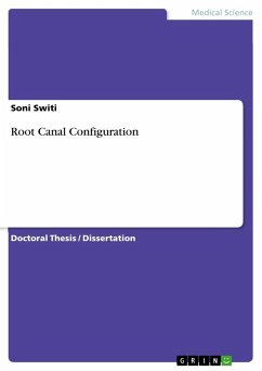 Root Canal Configuration