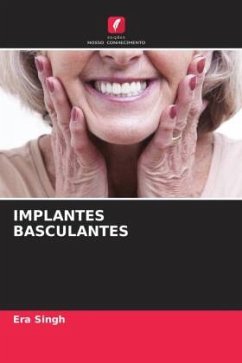Cover IMPLANTES BASCULANTES