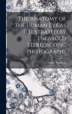 Cover The Anatomy of the Human eye as Illustrated by Enlarged Stereoscopic Photographs