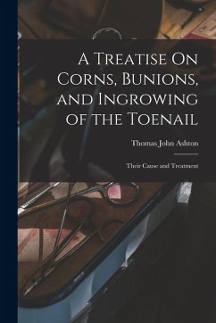 A Treatise On Corns, Bunions, and Ingrowing of the Toenail: Their Cause and Treatment - Ashton, Thomas John A Treatise On Corns, Bunions, and Ingrowing of the Toenail: Their Cause and Treatment - Ashton, Thomas John