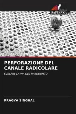 PERFORAZIONE DEL CANALE RADICOLARE - SINGHAL, PRAGYA