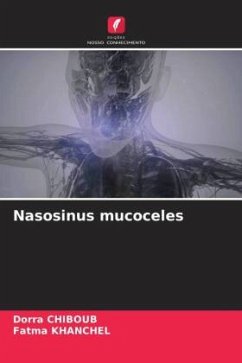 Nasosinus mucoceles - CHIBOUB, Dorra;khanchel, Fatma