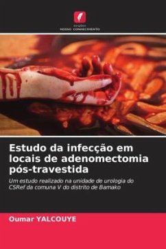 Estudo da infecção em locais de adenomectomia pós-travestida - Yalcouye, Oumar