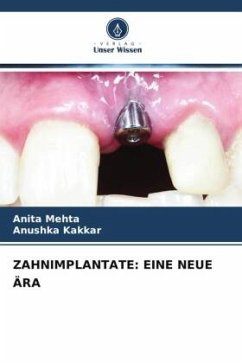 ZAHNIMPLANTATE: EINE NEUE ÄRA - Mehta, Anita;Kakkar, Anushka