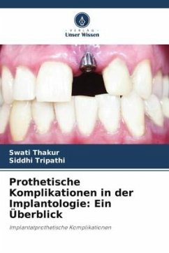 Prothetische Komplikationen in der Implantologie: Ein Überblick - Thakur, Swati;Tripathi, Siddhi