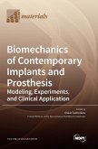 Biomechanics of Contemporary Implants and Prosthesis