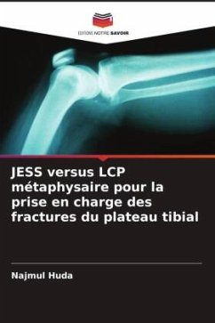 JESS versus LCP métaphysaire pour la prise en charge des fractures du plateau tibial - Huda, Najmul