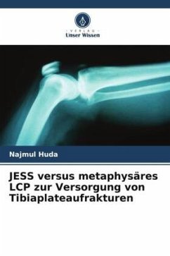 JESS versus metaphysäres LCP zur Versorgung von Tibiaplateaufrakturen - Huda, Najmul