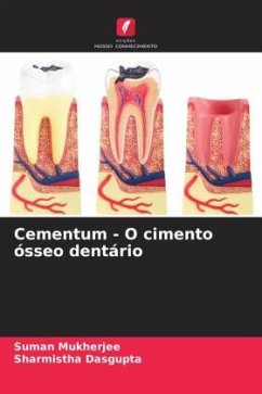 Cementum - O cimento ósseo dentário - Mukherjee, Suman;Dasgupta, Sharmistha