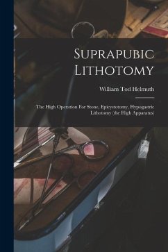 Suprapubic Lithotomy: The High Operation For Stone, Epicystotomy, Hypogastric Lithotomy (the High Apparatus) - Helmuth, William Tod