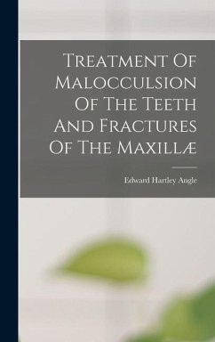 Treatment Of Malocculsion Of The Teeth And Fractures Of The Maxillæ - Angle, Edward Hartley