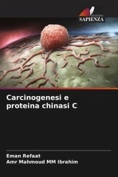 Carcinogenesi e proteina chinasi C - Refaat, Eman;MM Ibrahim, Amr Mahmoud