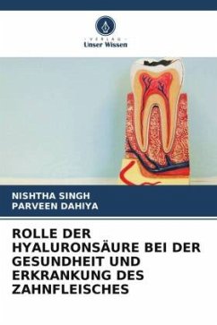 ROLLE DER HYALURONSÄURE BEI DER GESUNDHEIT UND ERKRANKUNG DES ZAHNFLEISCHES - Singh, Nishtha;Dahiya, Parveen