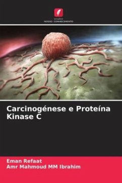 Carcinogénese e Proteína Kinase C - Refaat, Eman;MM Ibrahim, Amr Mahmoud