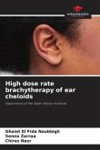 High dose rate brachytherapy of ear cheloids