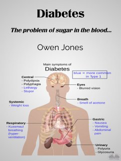 Diabetes (eBook, ePUB) - Jones, Owen