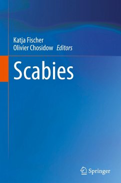 Scabies