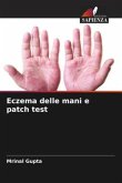 Eczema delle mani e patch test