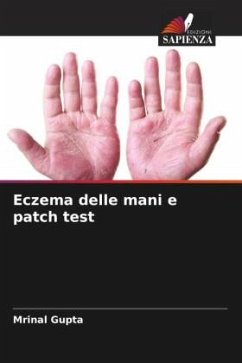 Eczema delle mani e patch test - Gupta, Mrinal