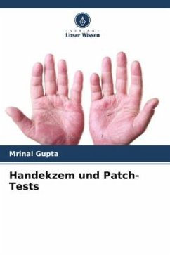 Handekzem und Patch-Tests - Gupta, Mrinal