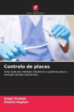 Controlo de placas - Dudeja, Anjali;Kapoor, Shalini