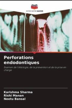 Perforations endodontiques - Sharma, Karishma;Manan, Rishi;Bansal, Neetu