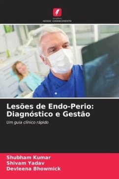 Lesões de Endo-Perio: Diagnóstico e Gestão - Kumar, Shubham;Yadav, Shivam;Bhowmick, Devleena