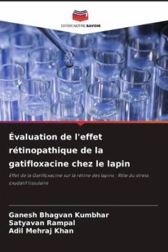 Évaluation de l'effet rétinopathique de la gatifloxacine chez le lapin - Kumbhar, Ganesh Bhagvan;Rampal, Satyavan;Khan, Adil Mehraj
