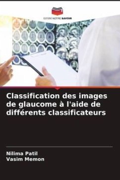 Classification des images de glaucome à l'aide de différents classificateurs - Patil, Nilima;Memon, Vasim