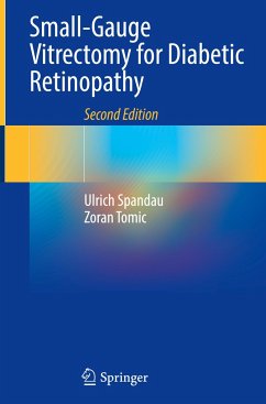 Small-Gauge Vitrectomy for Diabetic Retinopathy - Spandau, Ulrich;Tomic, Zoran