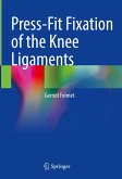 Press-Fit Fixation of the Knee Ligaments (eBook, PDF)