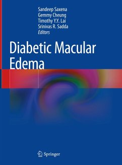 Diabetic Macular Edema (eBook, PDF)