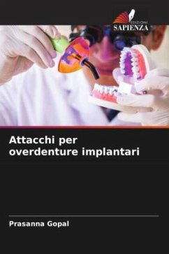 Attacchi per overdenture implantari - Gopal, Prasanna