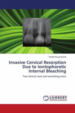 Invasive Cervical Resorption Due to Iontophoretic Internal Bleaching