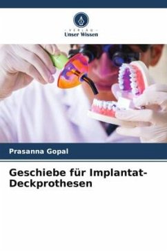 Geschiebe für Implantat-Deckprothesen - Gopal, Prasanna