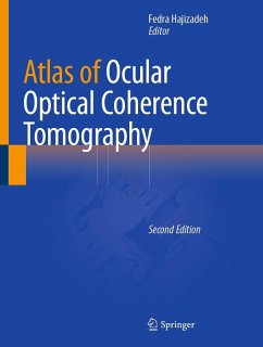 Atlas of Ocular Optical Coherence Tomography (eBook, PDF)