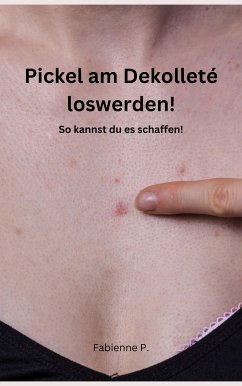 Pickel am Dekolleté loswerden! (eBook, ePUB) - P., Fabienne