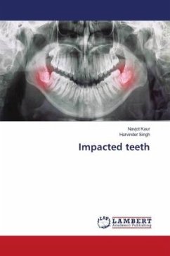 Impacted teeth - Kaur, Navjot;Singh, Harvinder